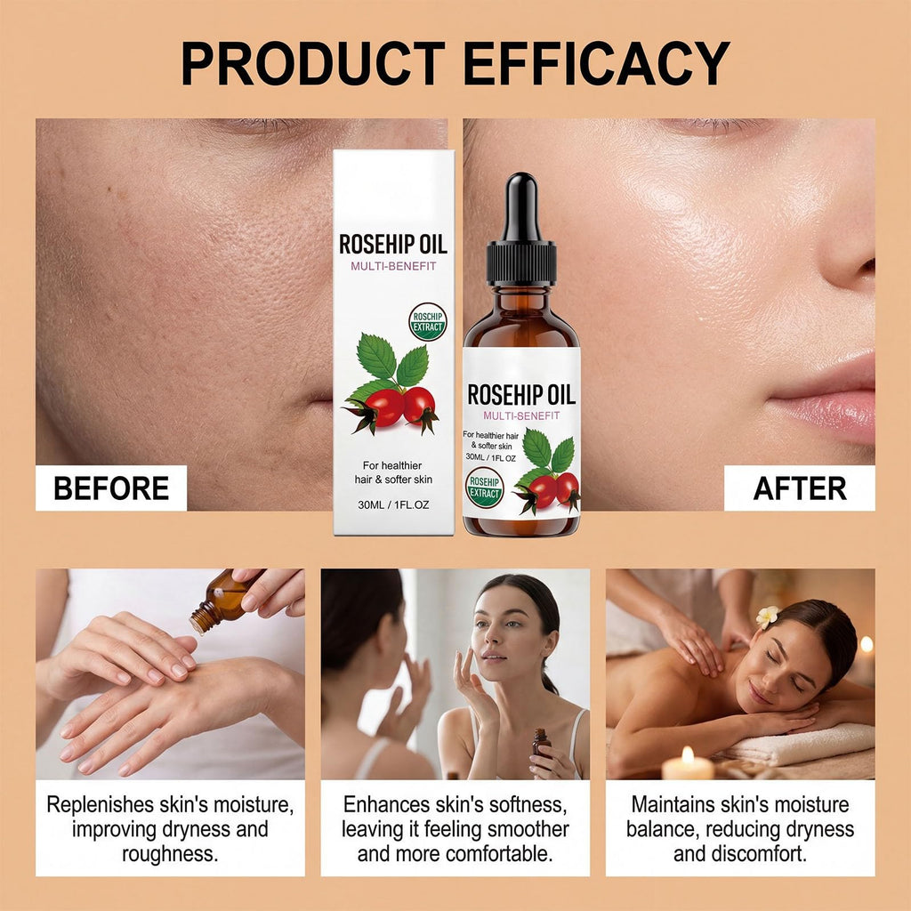 Rosehip Oil Organic Face Oil 1PC R88113